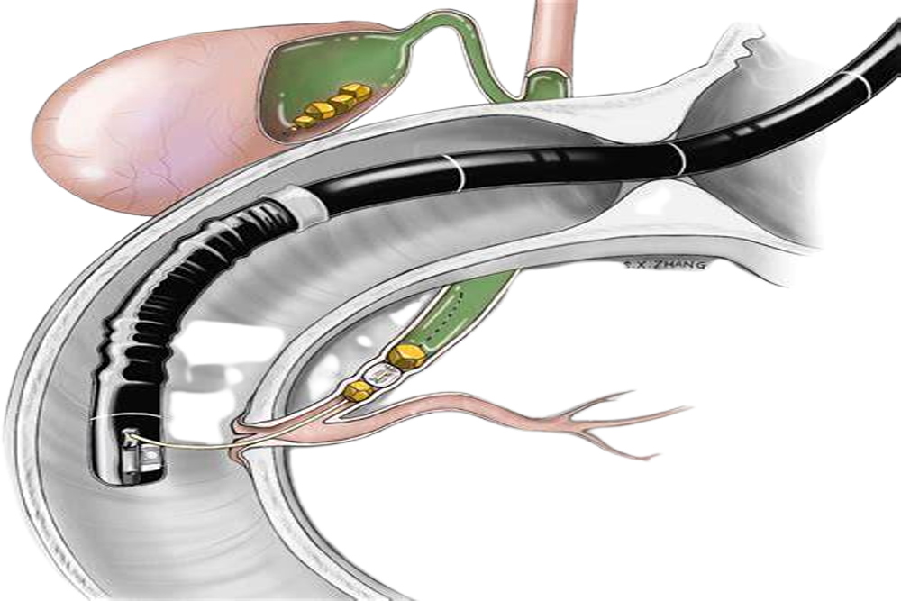 ERCP Medical Abbreviation | Dr Dipak Bhangale